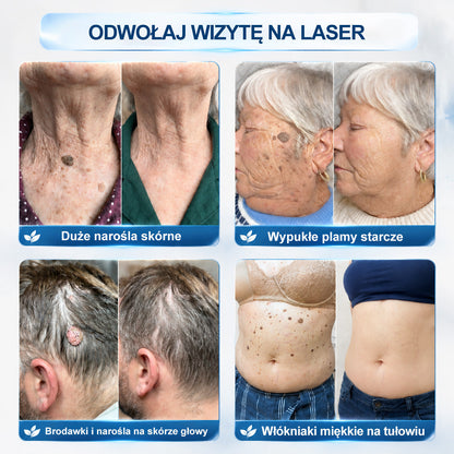 Oficjalny sklep markowy |☀️Hiskin® 7 𝑫𝒏𝒊 𝑷𝒓𝒆𝒑𝒂𝒓𝒂𝒕 𝑫𝒐 𝑼𝒔𝒖𝒘𝒂𝒏𝒊𝒂 𝑾łó𝒌𝒏𝒊𝒂𝒌ó𝒘 𝑴𝒊ę𝒌𝒌𝒊𝒄𝒉 𝑰 𝑷𝒓𝒛𝒆𝒃𝒂𝒓𝒘𝒊𝒆ń(𝐁𝐞𝐳 𝐁ó𝐥𝐮, 𝐁𝐞𝐳 𝐁𝐥𝐢𝐳𝐧 – 𝐑𝐨𝐥𝐥-𝐨𝐧)